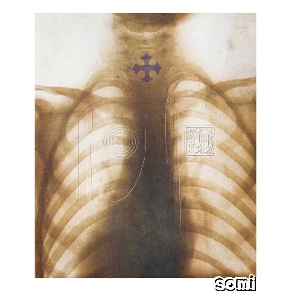 Image Cover